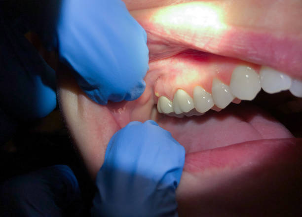 Best Cracked Tooth Emergency Dentist  in Wharton, NJ
